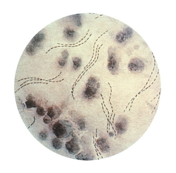 Óleos essenciais contra Cancro mole (Haemophilus ducreyi)